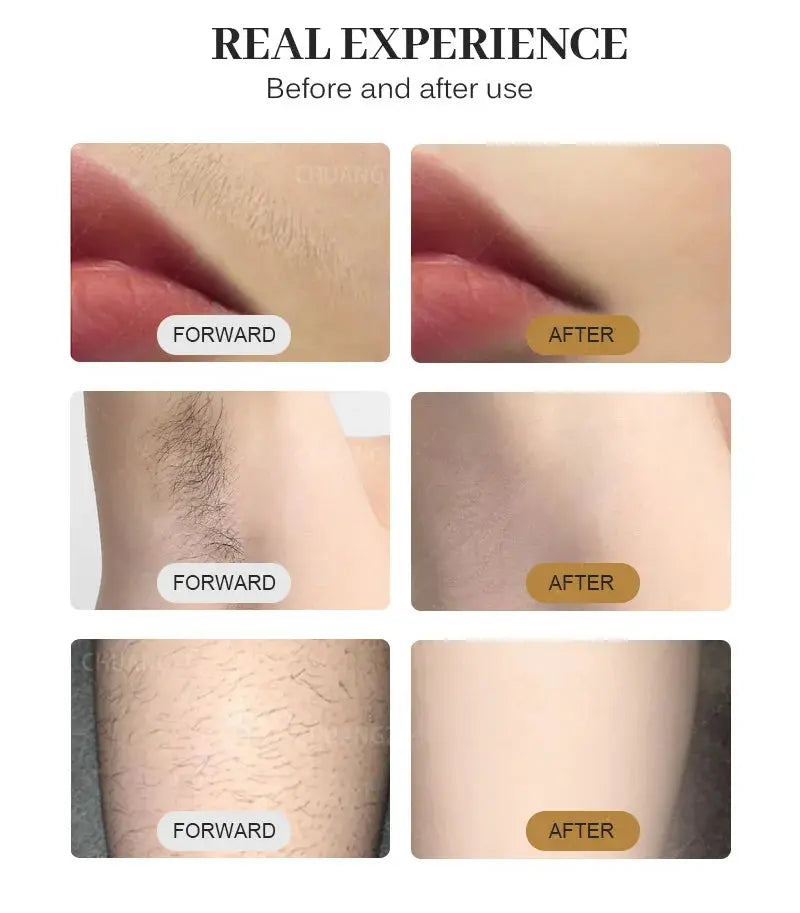 4000W Face 808nm Diode Laser Hair Removal Machine Alexandrit Permanent Painless Physical Underarm Body Care Depilation Equipment Smart_Life_Tech